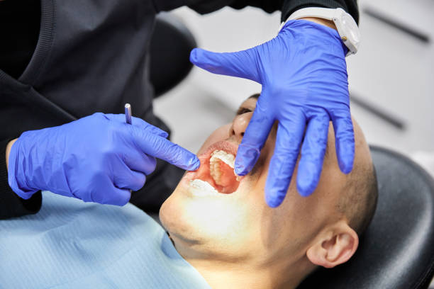 Best Emergency Tooth Extraction in Belpre, OH